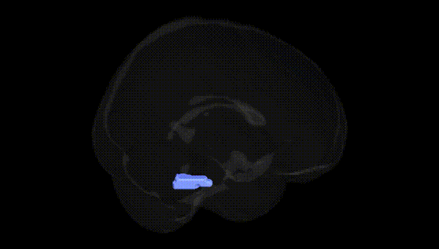 Full Brain Black