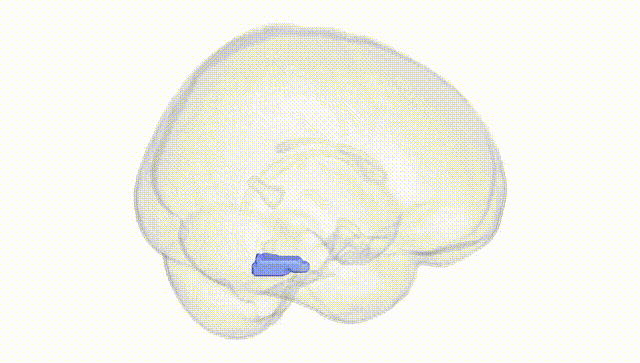 Full Brain White