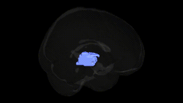 Full Brain Black