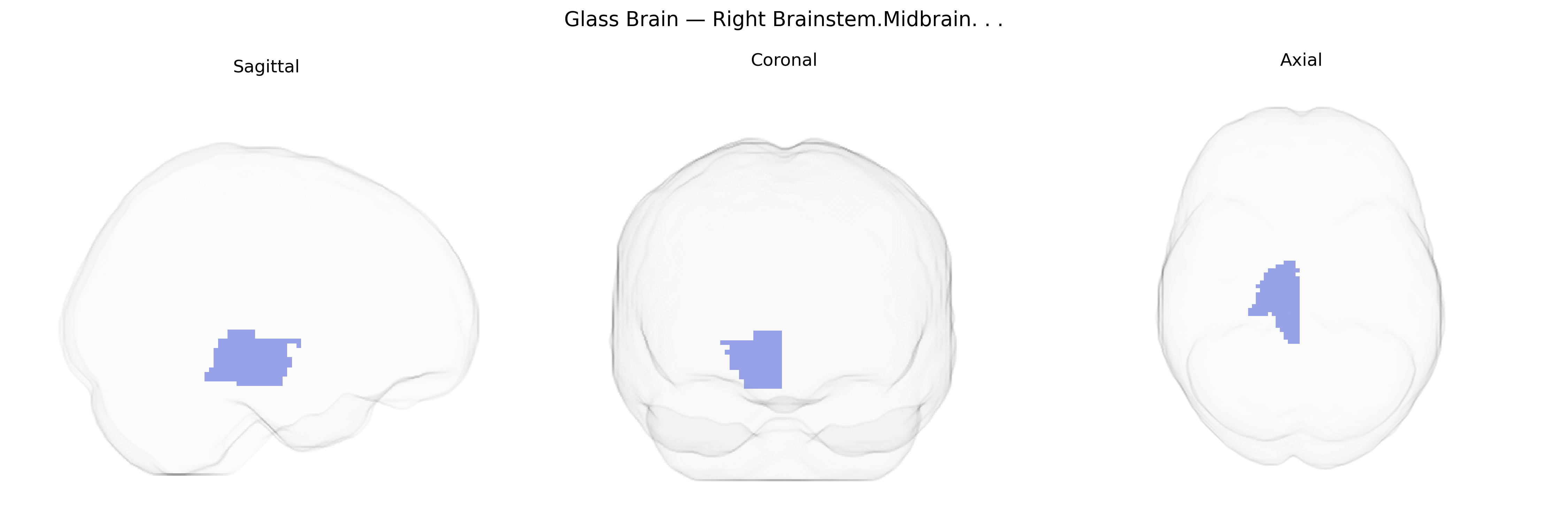 Triplanar Ghost Brain