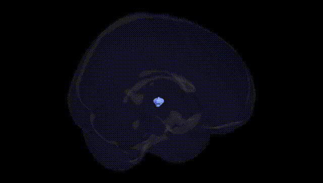 Full Brain Black