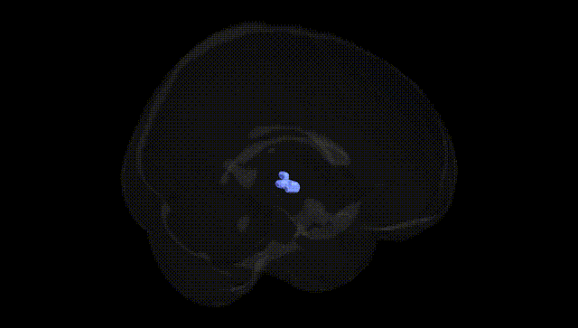 Full Brain Black