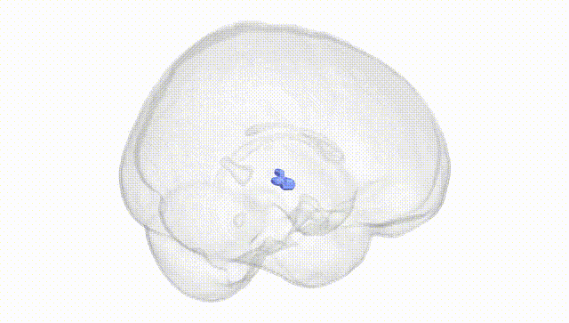 Full Brain White