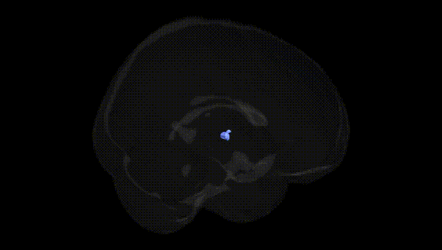 Full Brain Black