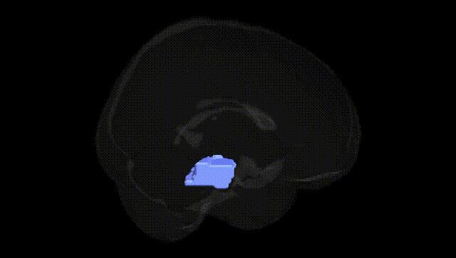 Full Brain Black