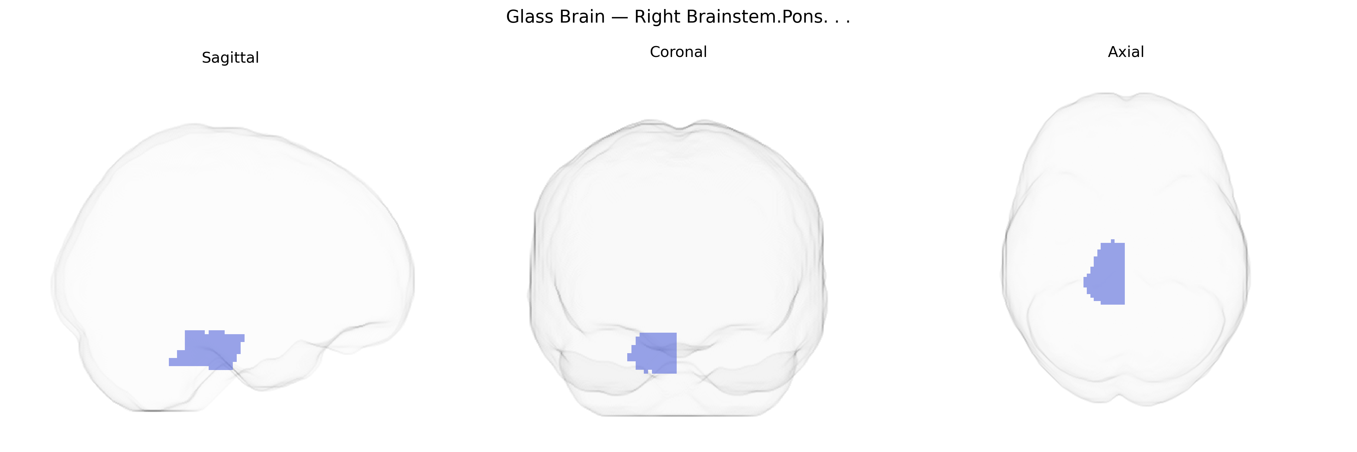 Triplanar Ghost Brain