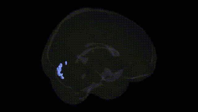 Full Brain Black
