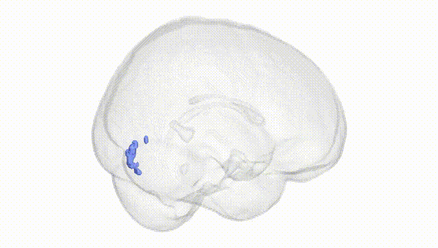 Full Brain White