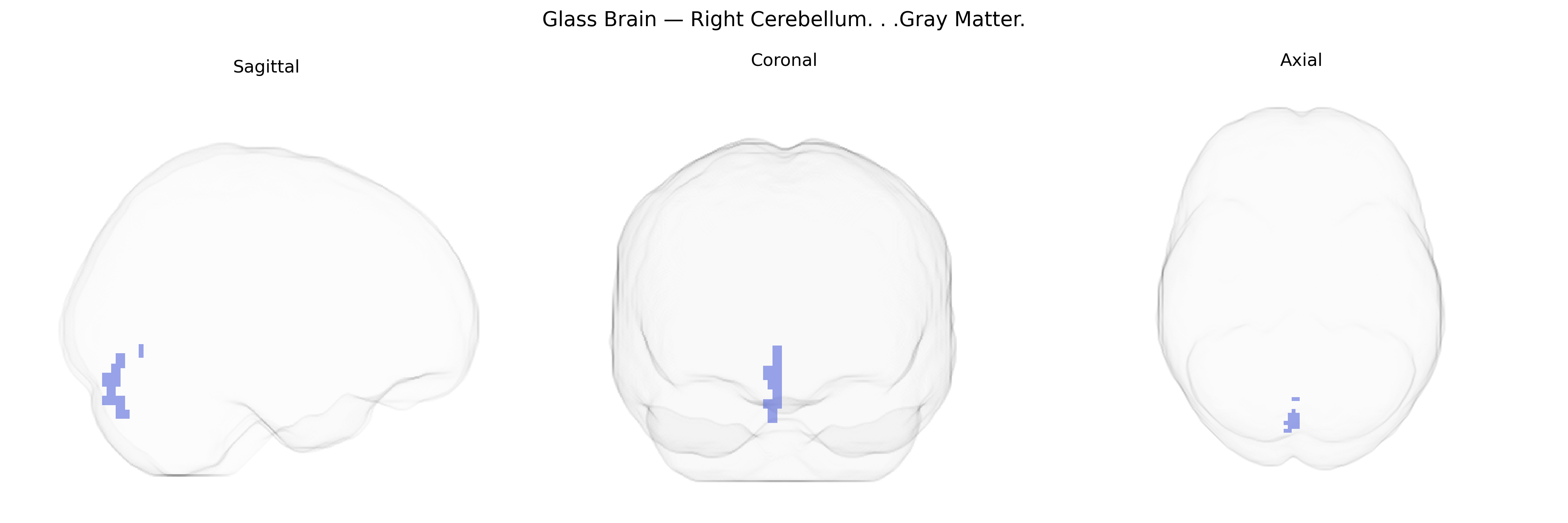 Triplanar Ghost Brain