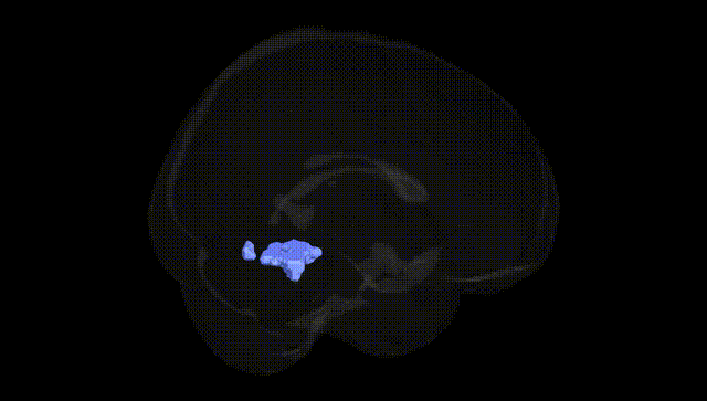 Full Brain Black
