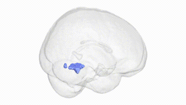 Full Brain White