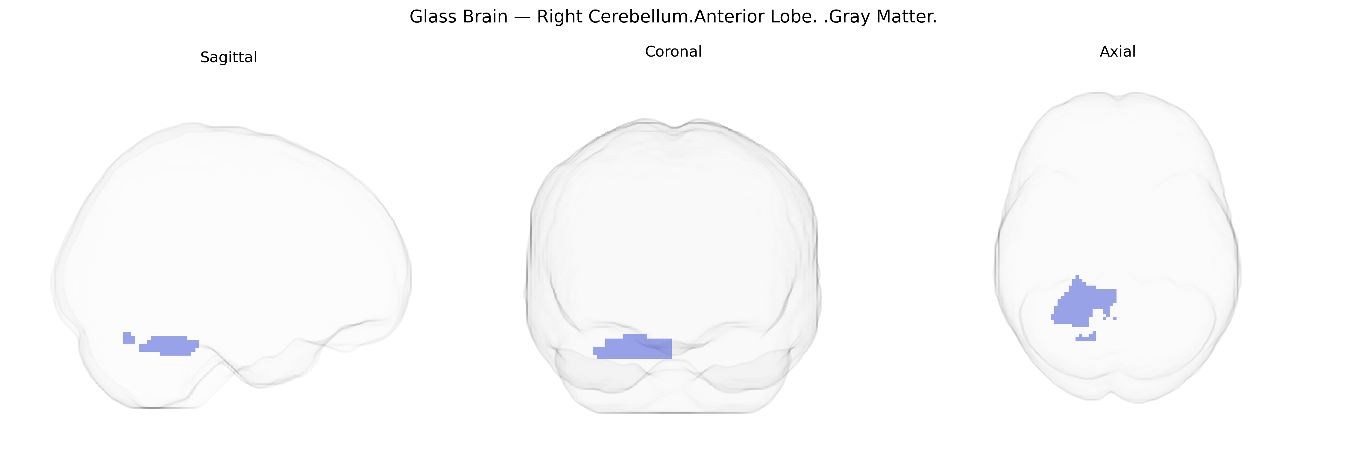 Triplanar Ghost Brain