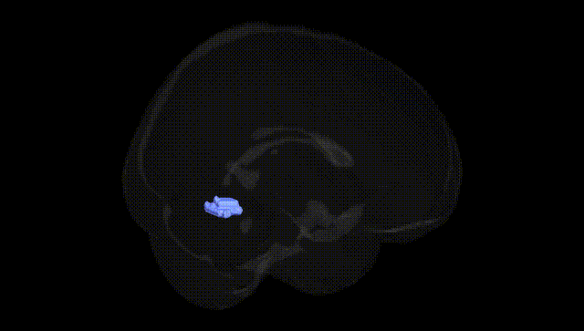 Full Brain Black