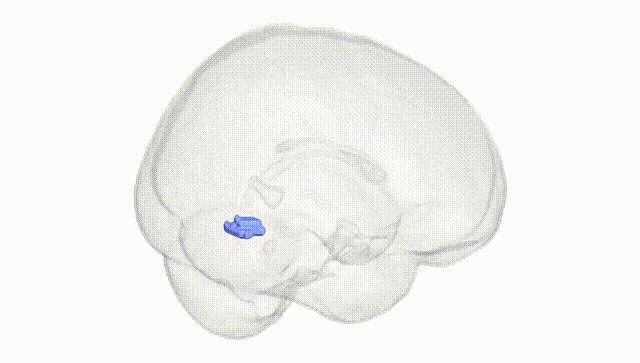 Full Brain White