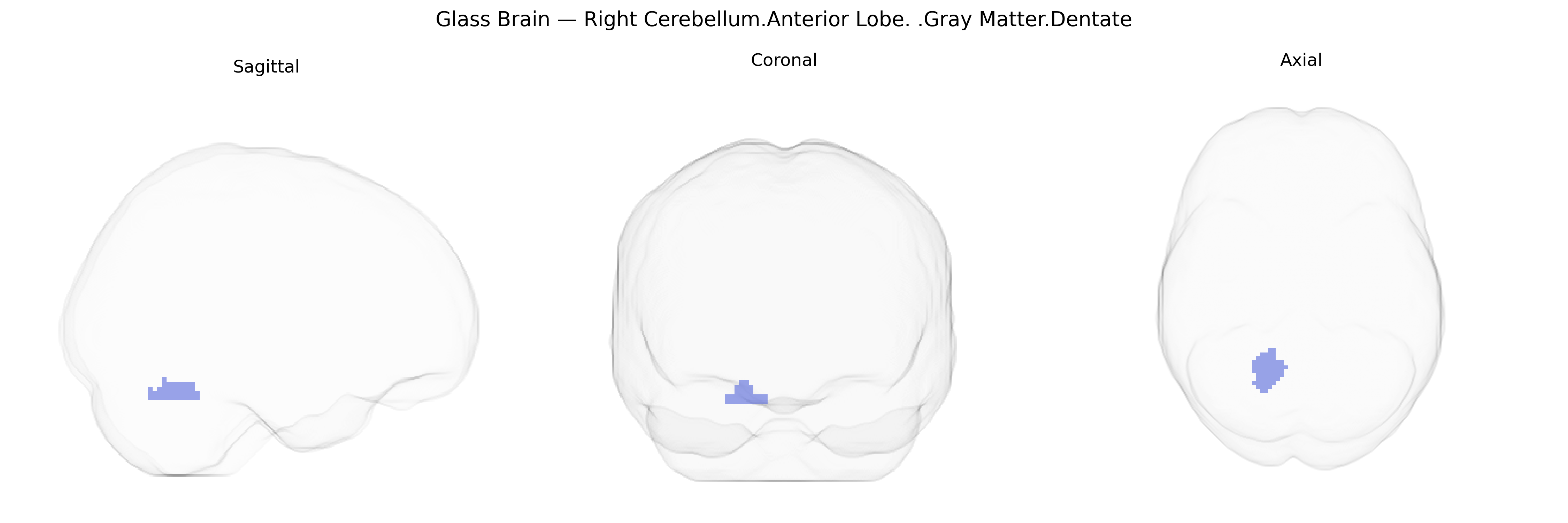 Triplanar Ghost Brain