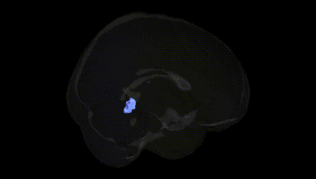 Full Brain Black