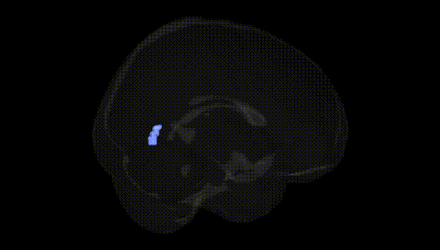 Full Brain Black