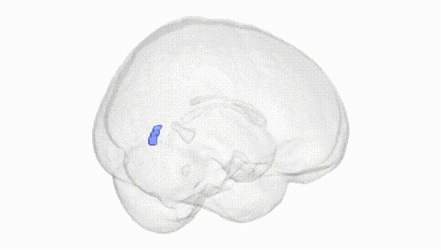 Full Brain White