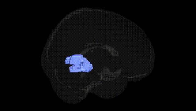 Full Brain Black