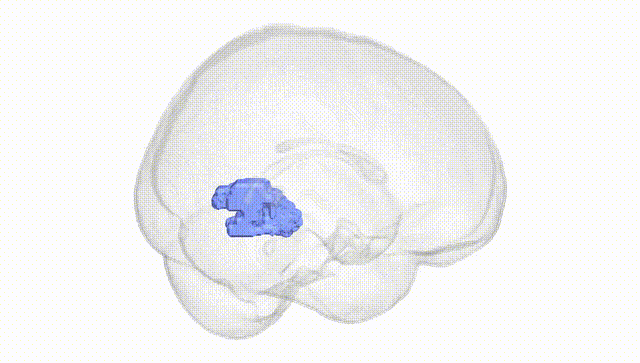 Full Brain White