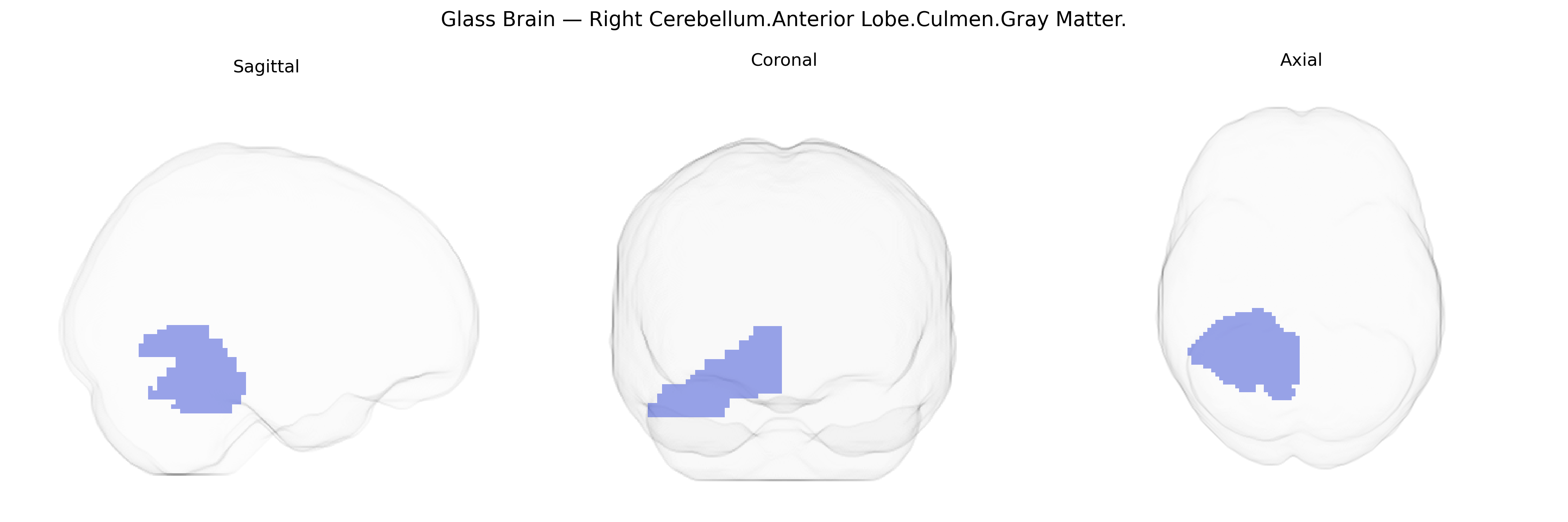 Triplanar Ghost Brain