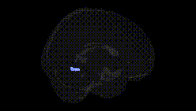 Full Brain Black