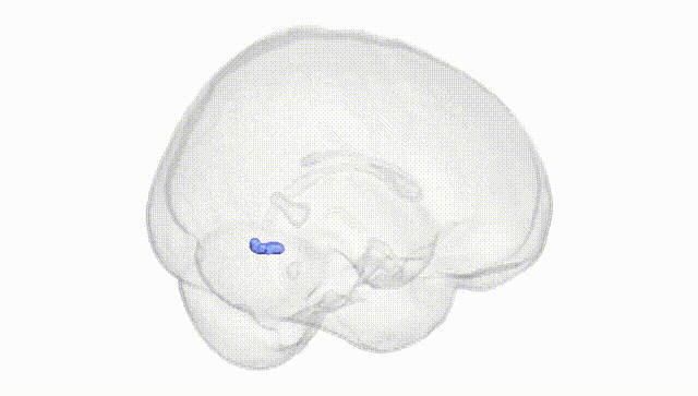 Full Brain White