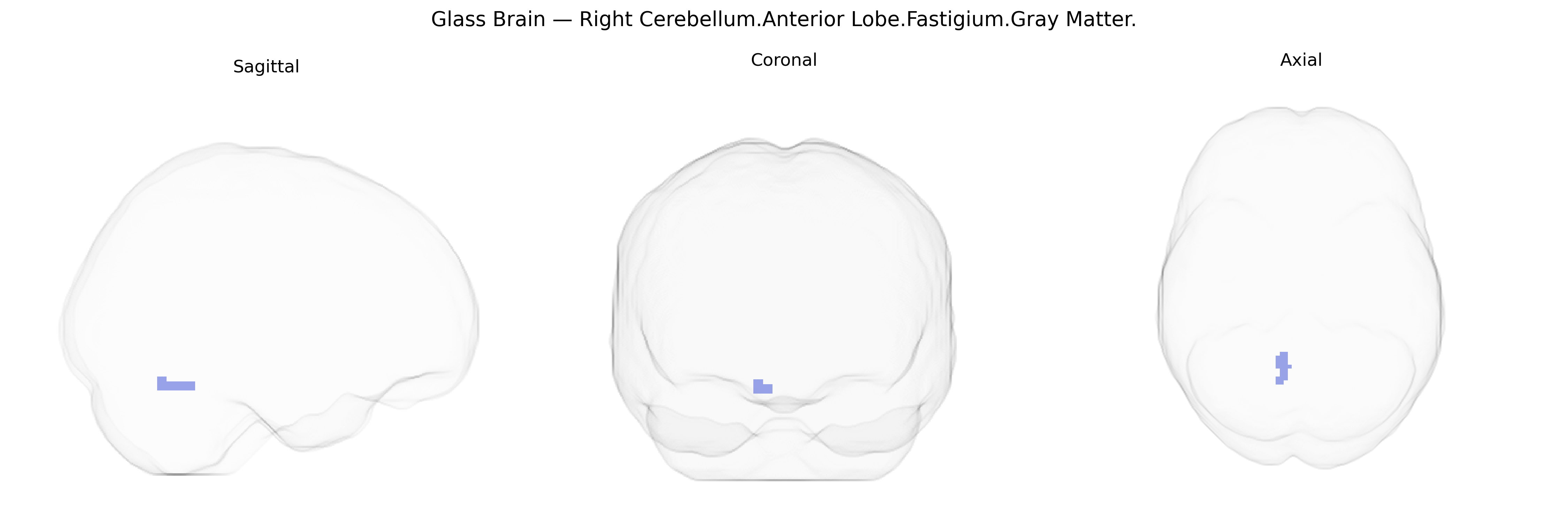 Triplanar Ghost Brain