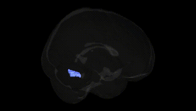Full Brain Black