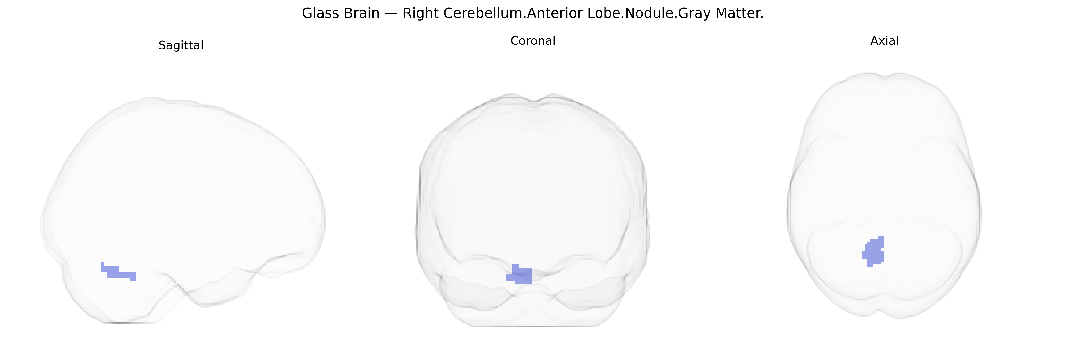 Triplanar Ghost Brain