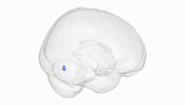 Full Brain White