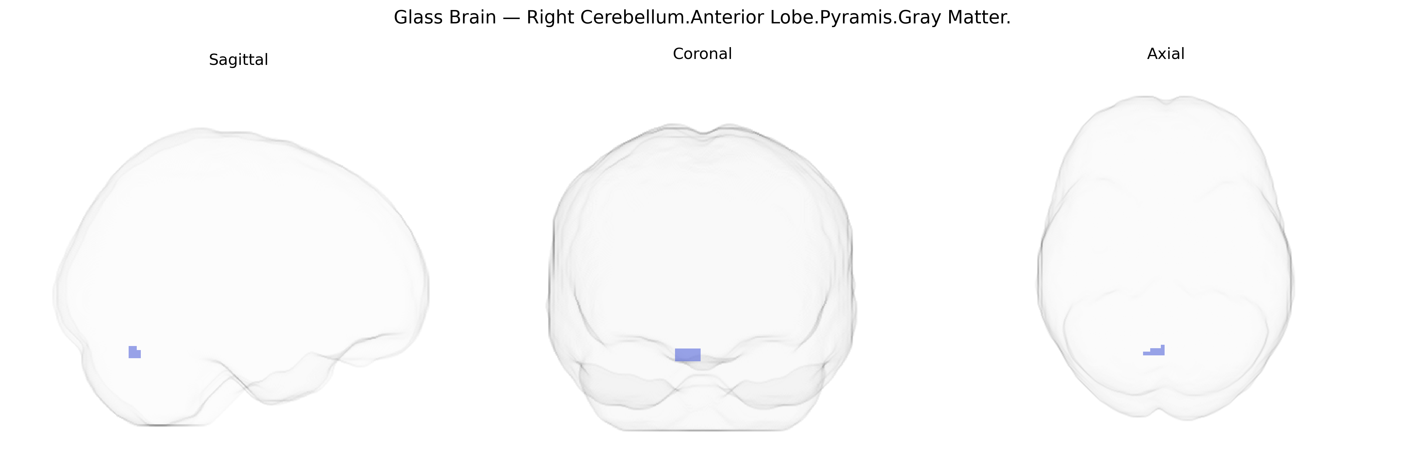 Triplanar Ghost Brain