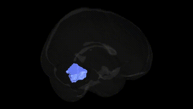 Full Brain Black