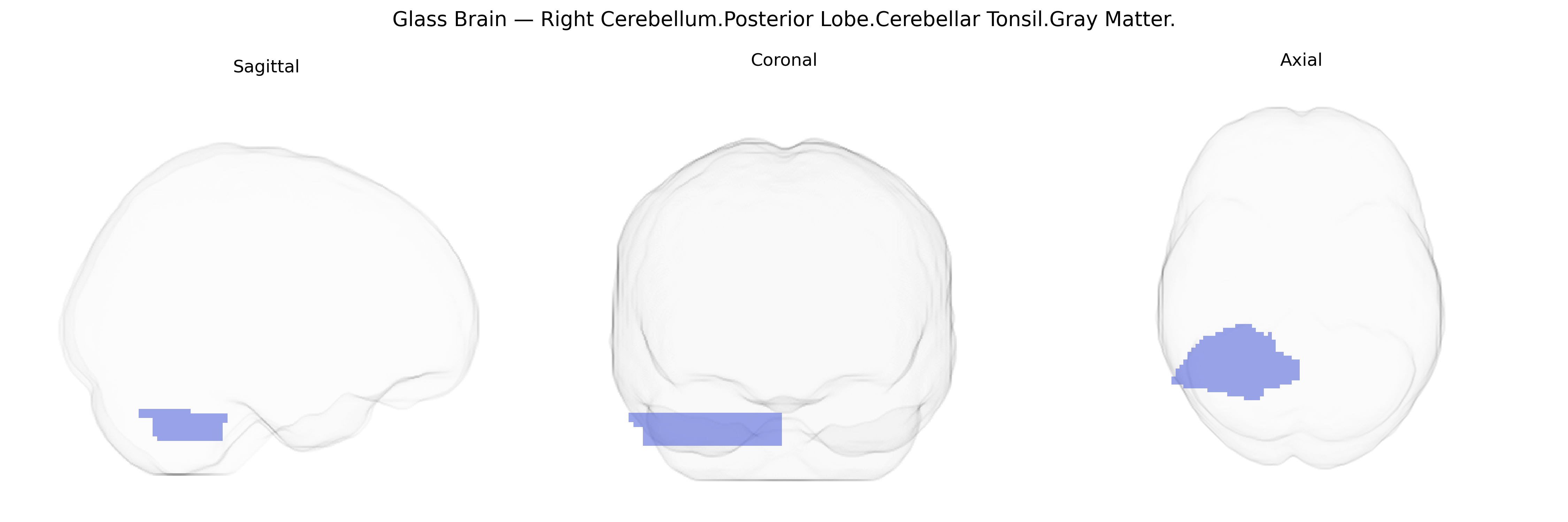 Triplanar Ghost Brain