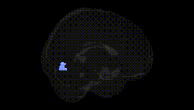 Full Brain Black