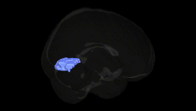 Full Brain Black