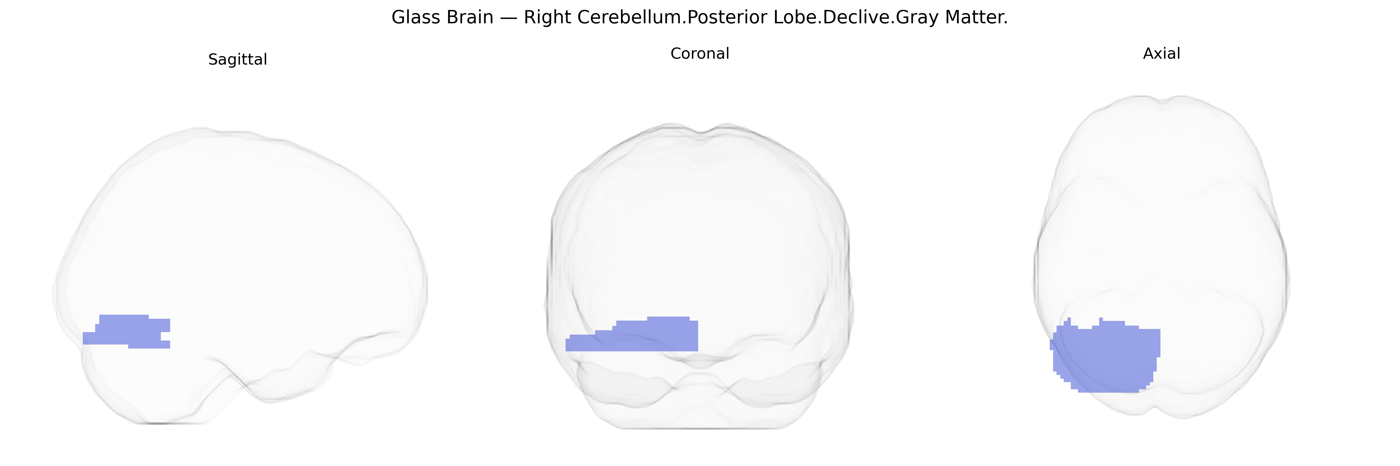 Triplanar Ghost Brain