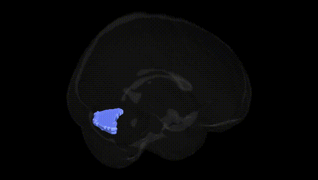 Full Brain Black