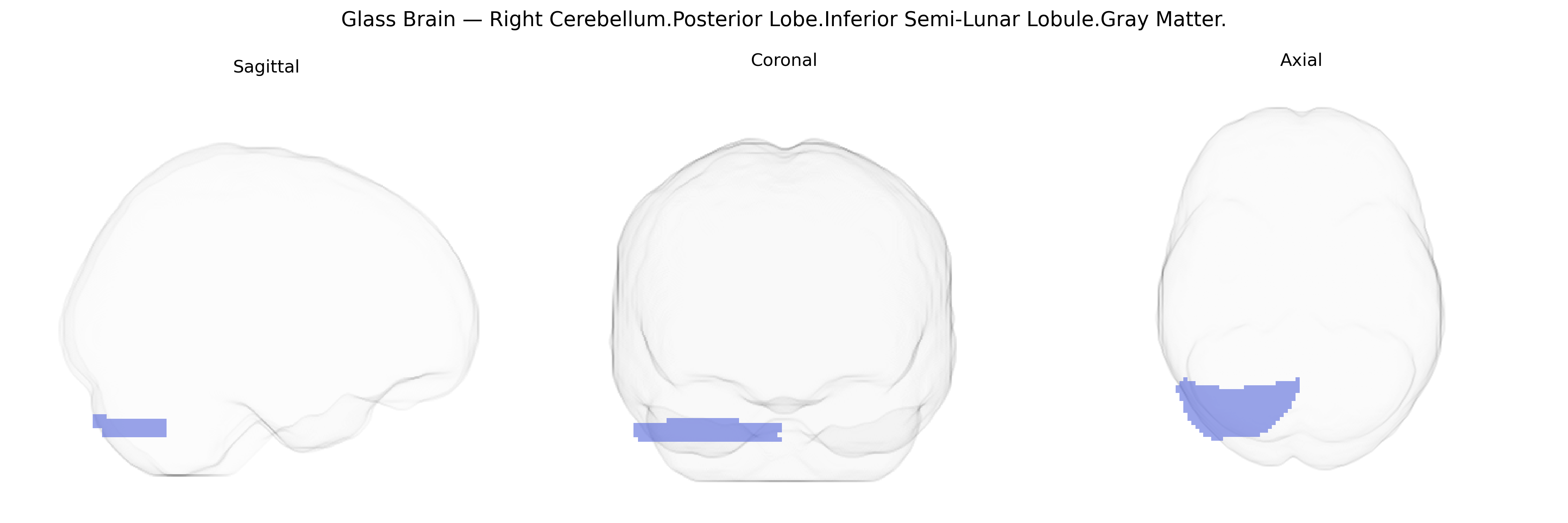 Triplanar Ghost Brain