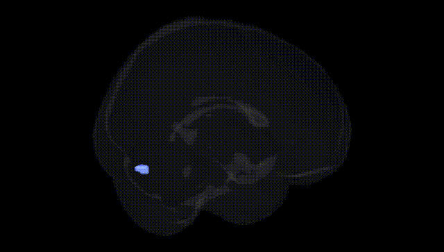 Full Brain Black