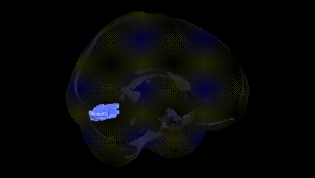 Full Brain Black
