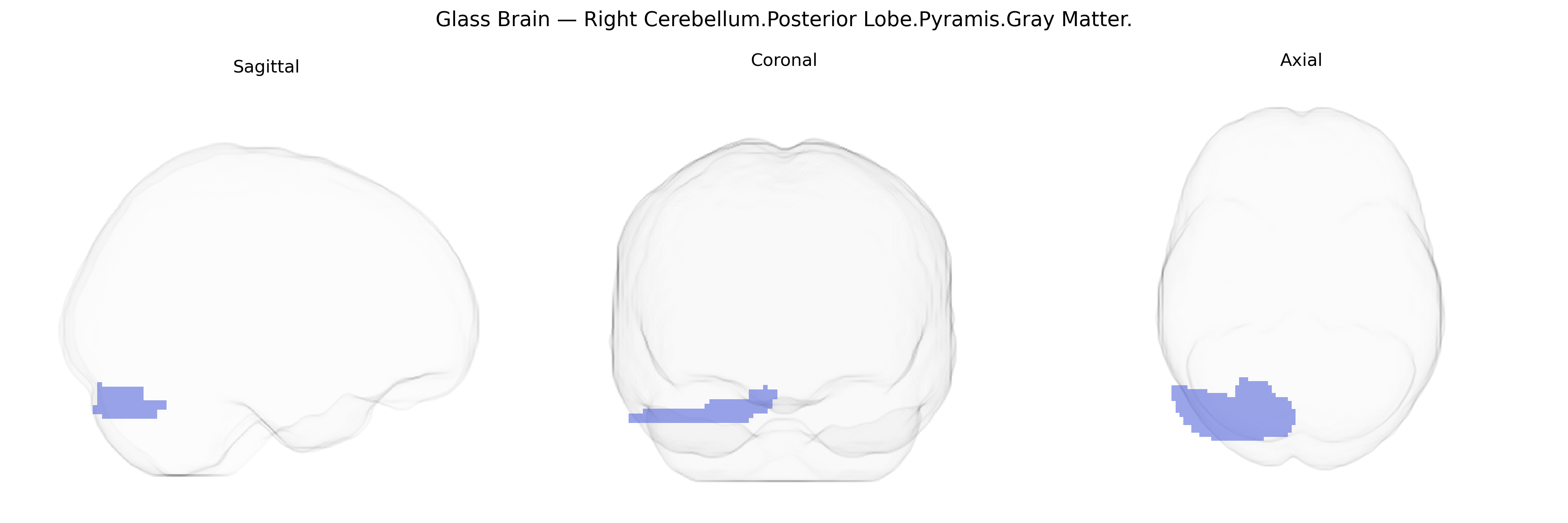 Triplanar Ghost Brain