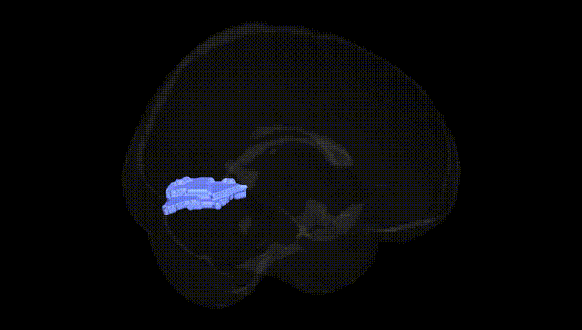 Full Brain Black