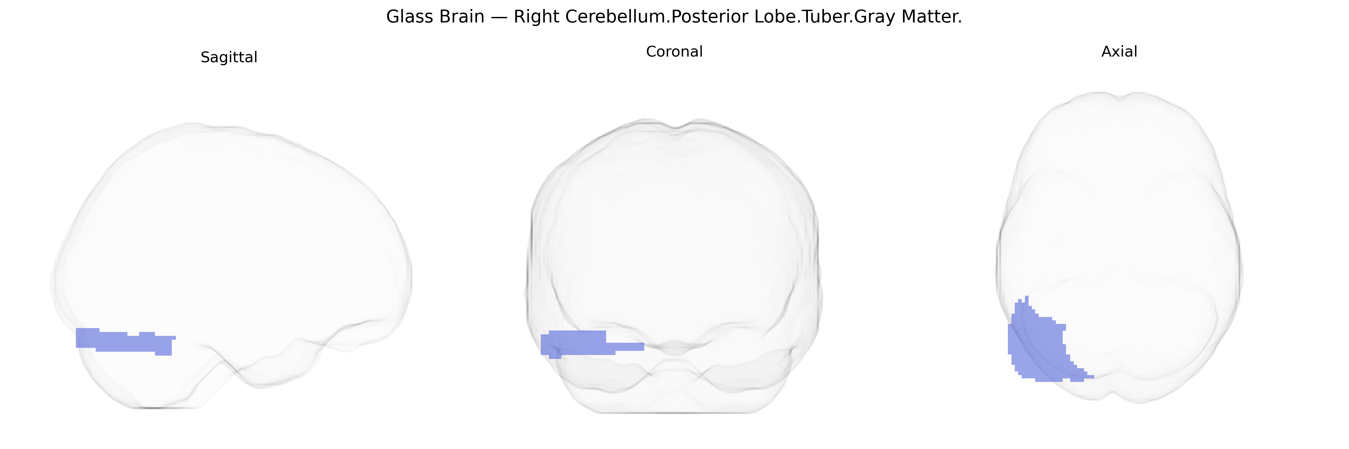 Triplanar Ghost Brain
