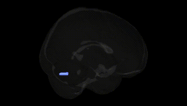 Full Brain Black