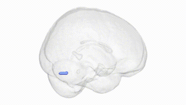 Full Brain White