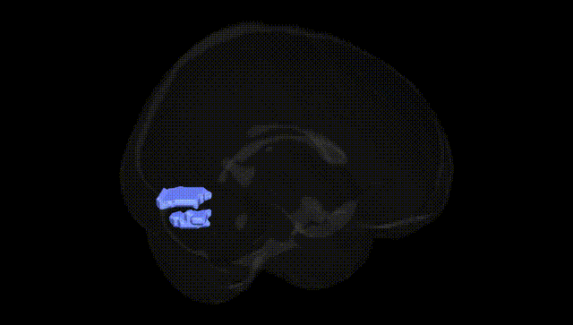 Full Brain Black