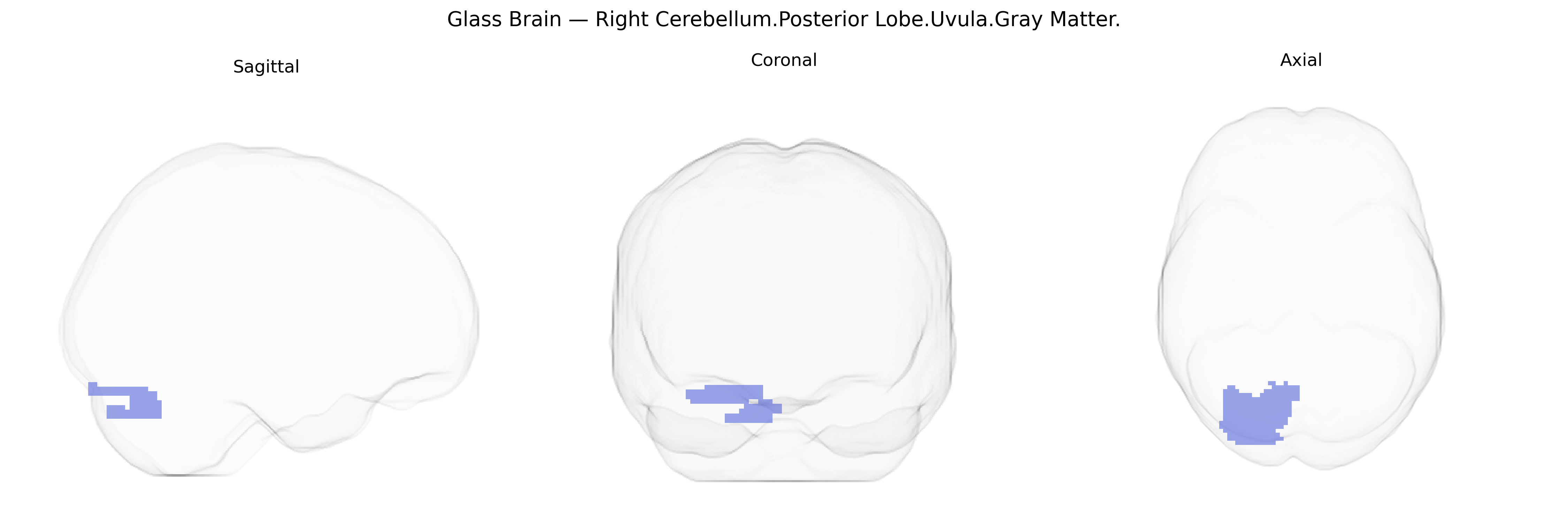 Triplanar Ghost Brain