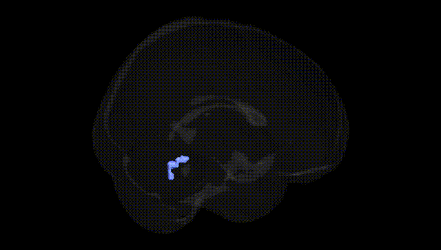 Full Brain Black