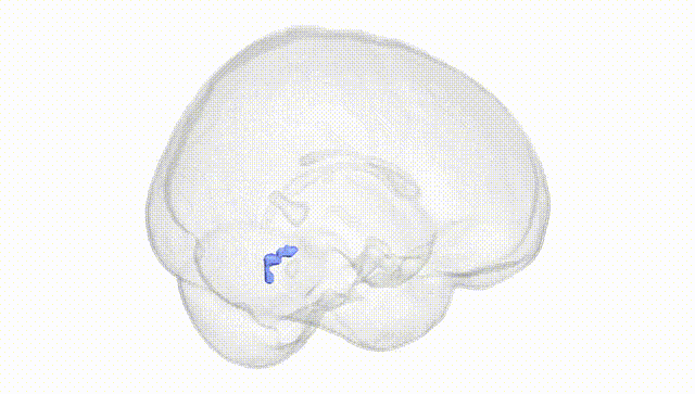 Full Brain White